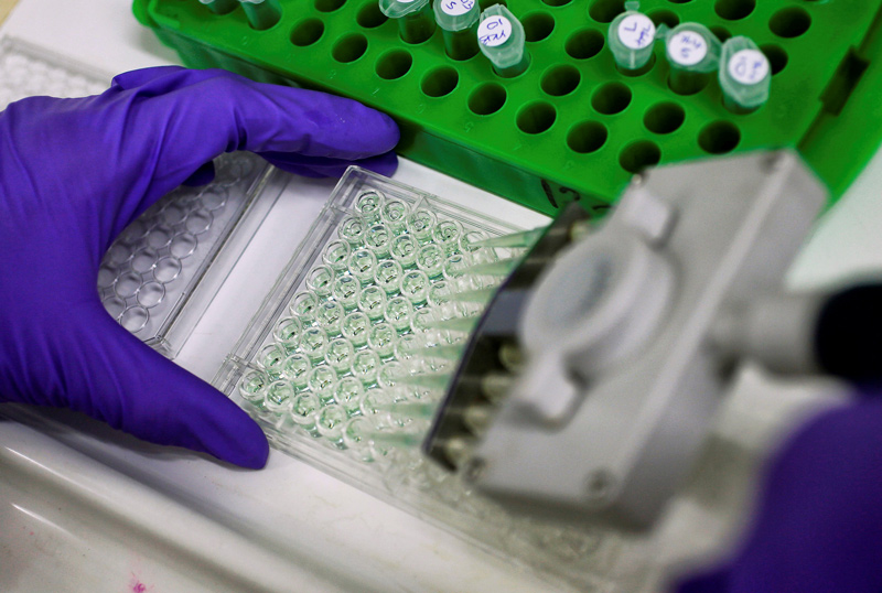 A scientist prepares protein samples for analysis in a lab