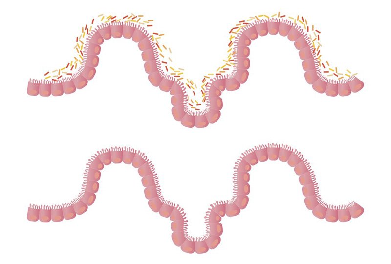 Microbes in the gut can change the effects of genetic mutations