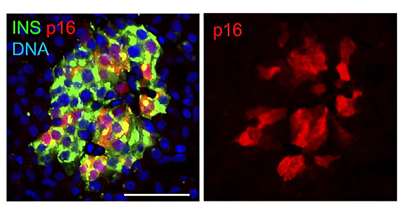 Adult pancreatic islets marking senescent beta cells: Beta cells (marked in green) in the pancreas are organized in structures termed islets. In most adults, it was found that a subset become senescent and display the marker p16, shown here in red. The image shows a typical islet in an adult pancreas. Scale bar = 50 μm.